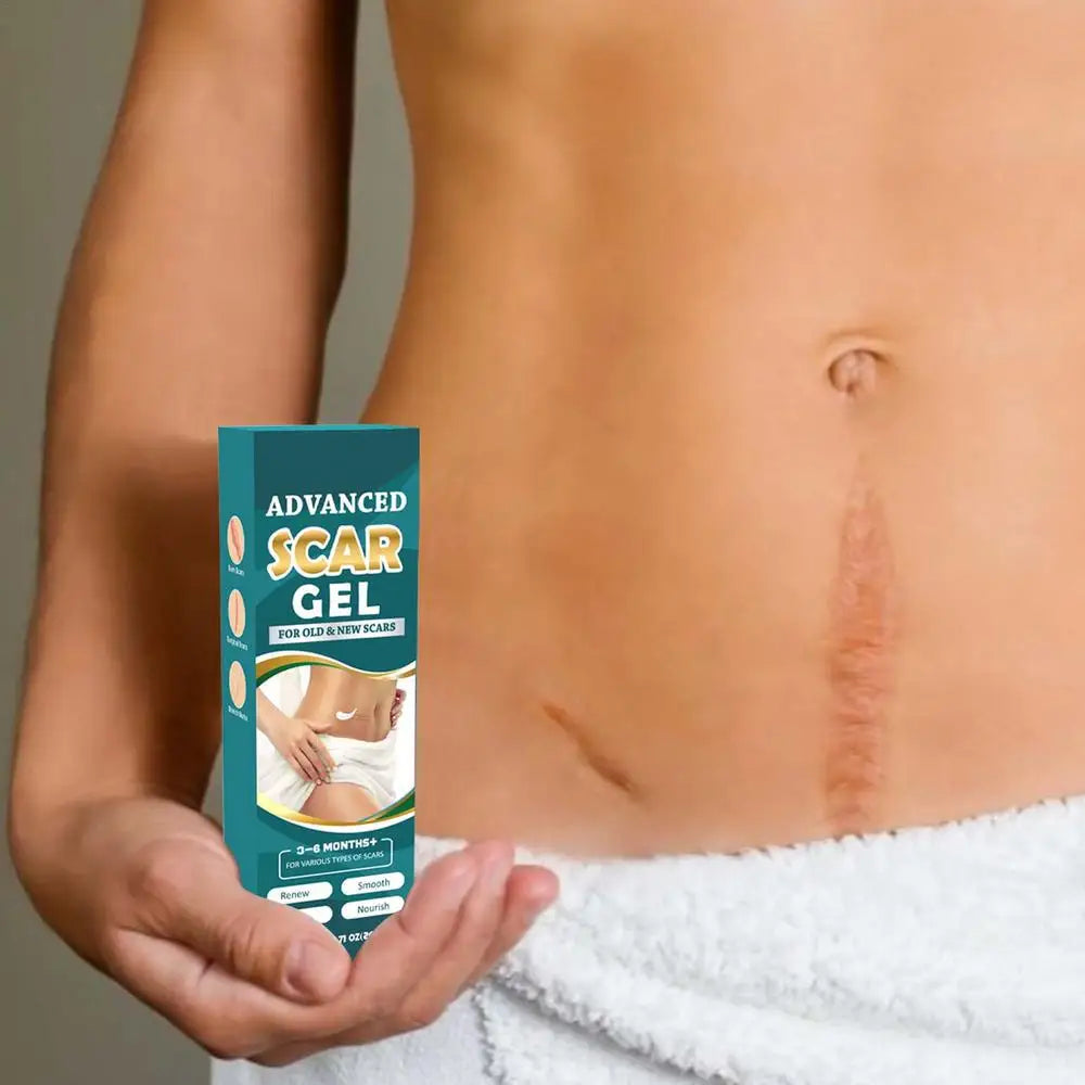 Scar Remover Cream