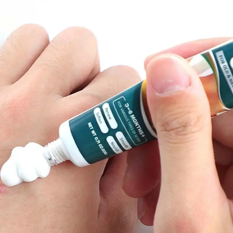 Scar Remover Cream